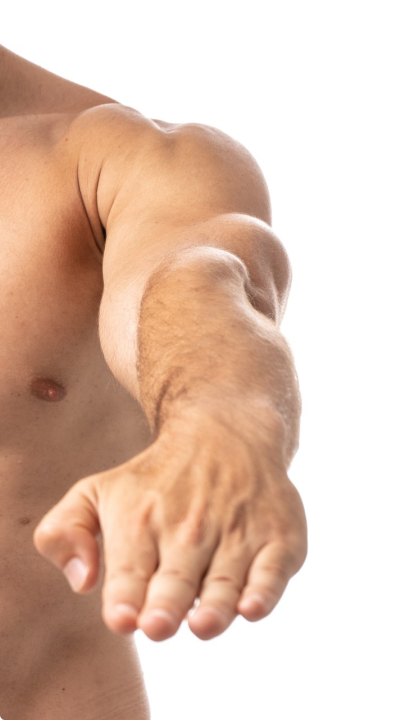 Arms laser hair removal treatment for men in Miami