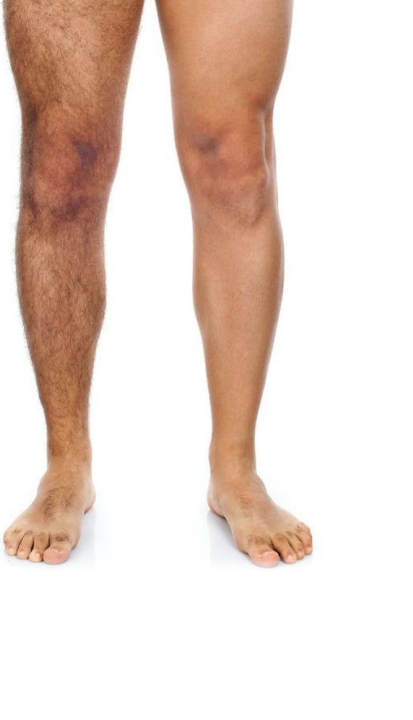 Men Legs Hair Removal